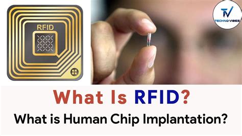 rfid chip adopted|rfid tags for humans.